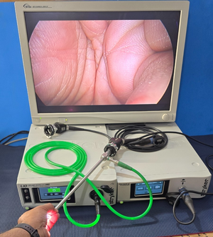 Stryker Precision AC Camera System ,LI0 Light Source Green Cable, WiSe Monitor